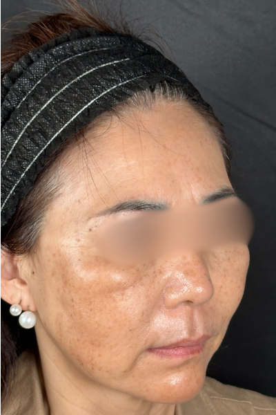 手術前の状態 その1