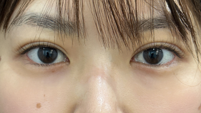 手术前的状态 其一