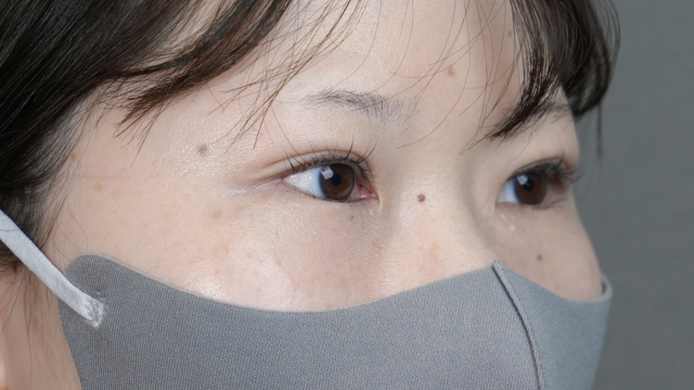 手术前的状态 其一