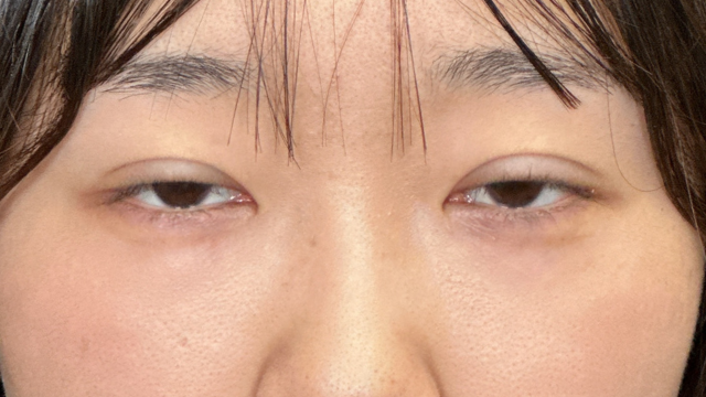 Postoperative Condition Part 1