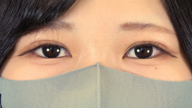 手術前の状態 その1