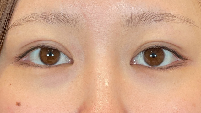 Postoperative Condition Part 1