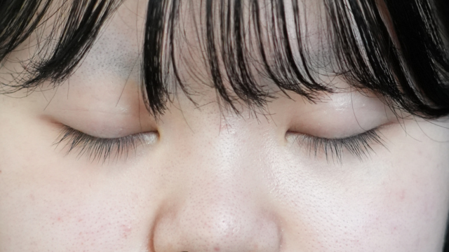 手术前的状态 其一