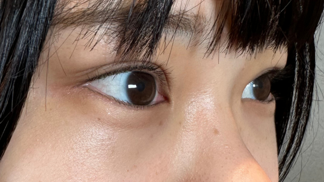 手术前的状态 其一