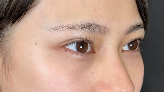 手术前的状态 其一