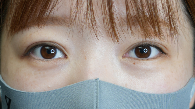 手术前的状态 其一