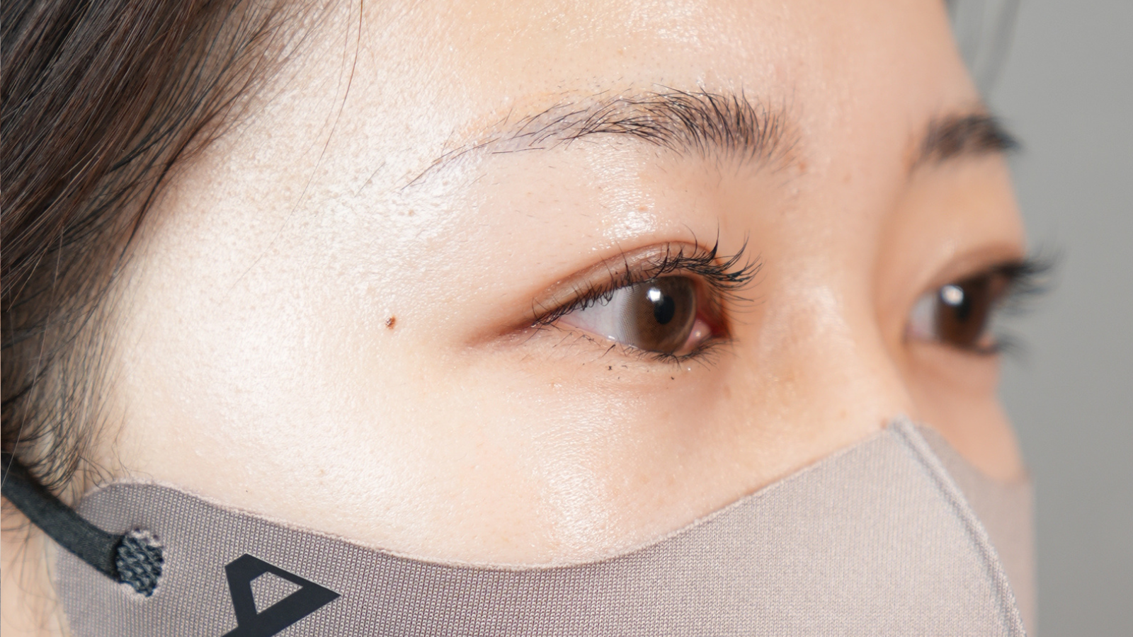 手術前の状態 その1