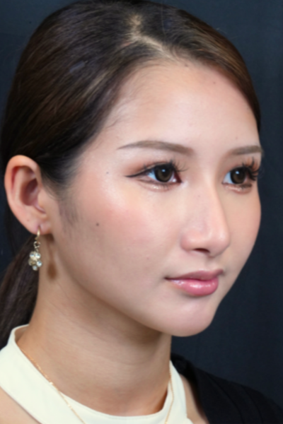 Postoperative Condition Part 1