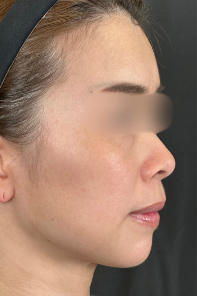 手术前的状态 其一