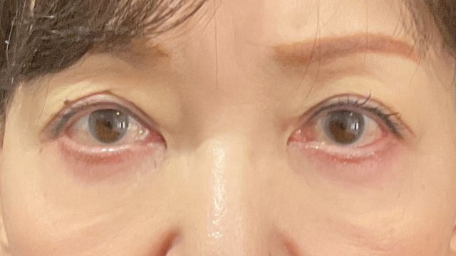 Postoperative Condition Part 1