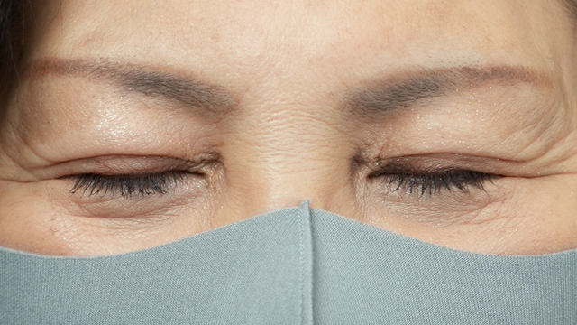 手术前的状态 其一