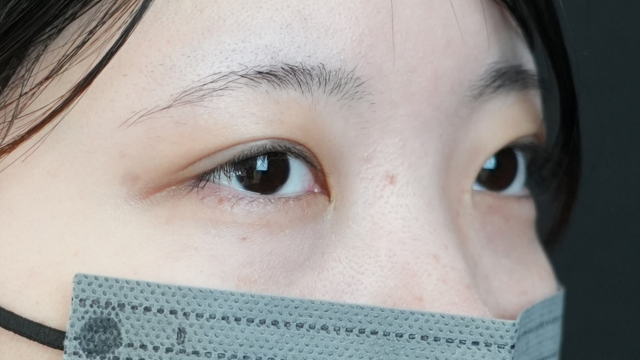 手术前的状态 其一