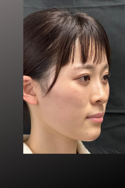 手術前の状態 その1