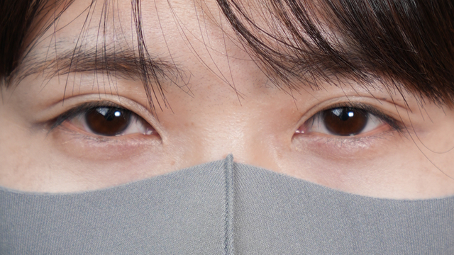 手术前的状态 其一