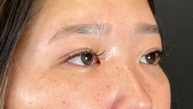 手术前的状态 其一