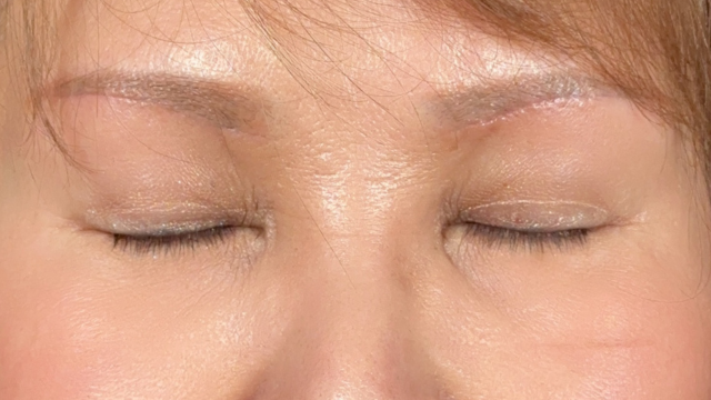 Postoperative Condition Part 1