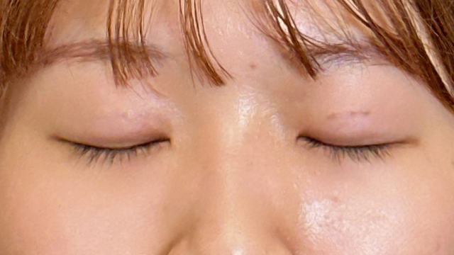 手术前的状态 其一