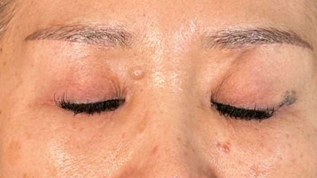 Postoperative Condition Part 1