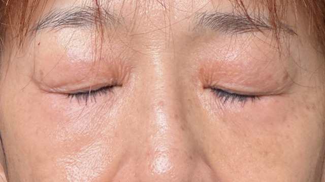 手术前的状态 其一