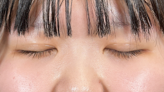 手术前的状态 其一