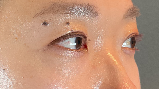 Postoperative Condition Part 1