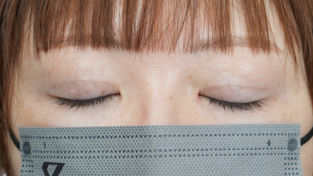 手术前的状态 其一