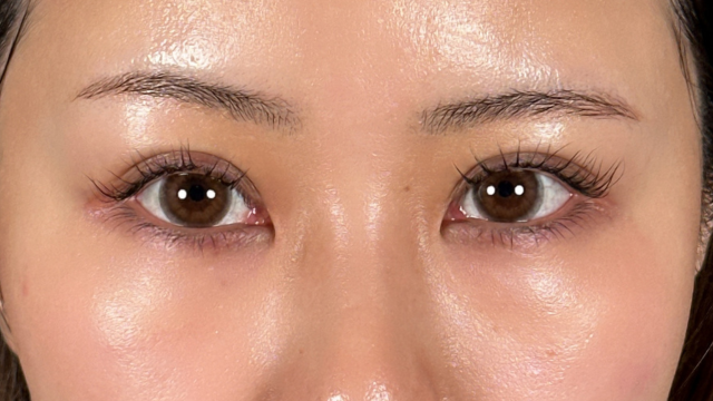 手术前的状态 其一