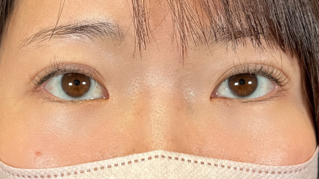 手术前的状态 其一