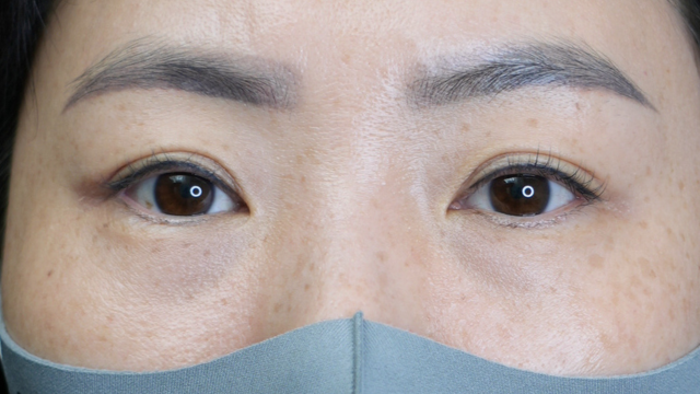 Postoperative Condition Part 1