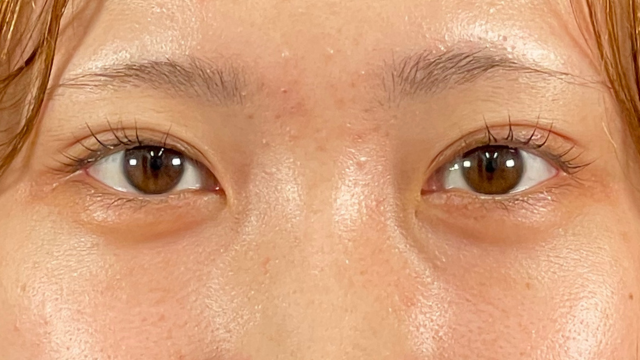 手术前的状态 其一