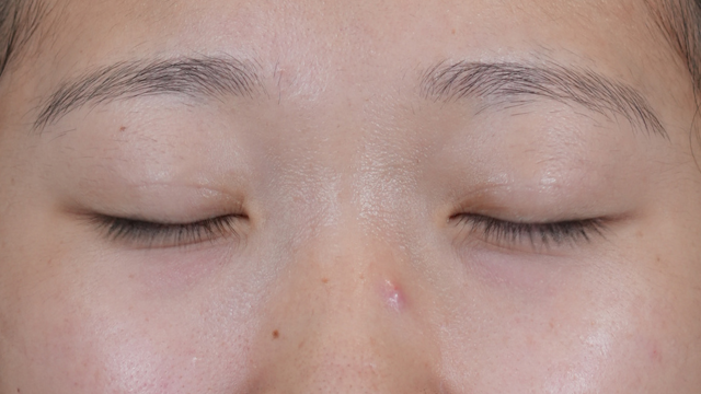 手術前の状態 その1