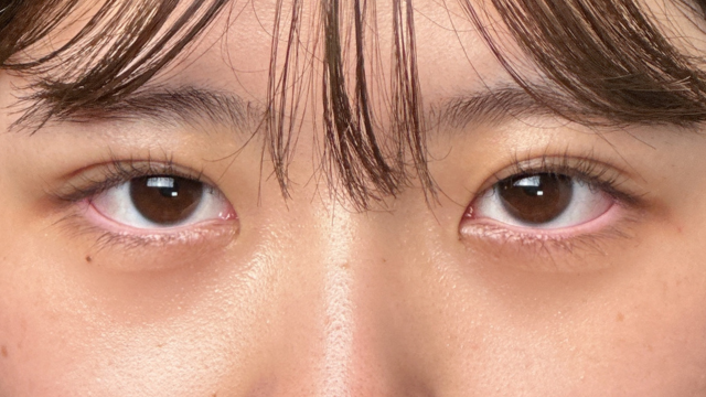 手术前的状态 其一