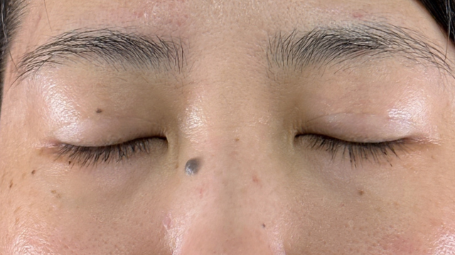 Postoperative Condition Part 1