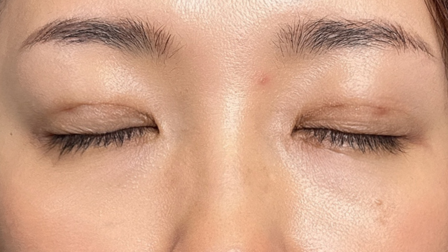 手术前的状态 其一