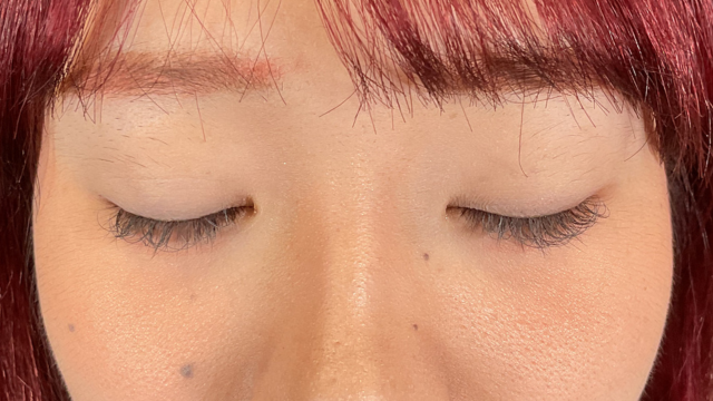 手术前的状态 其一