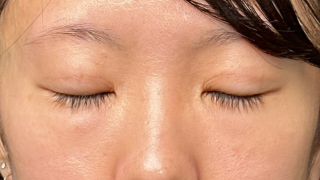 手术前的状态 其一