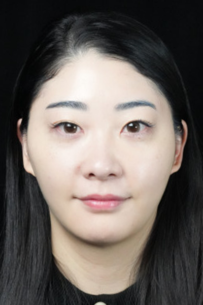 手术前的状态 其一