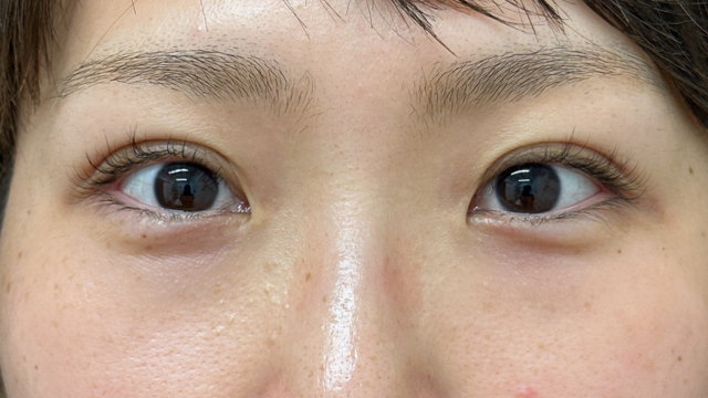 手术前的状态 其一