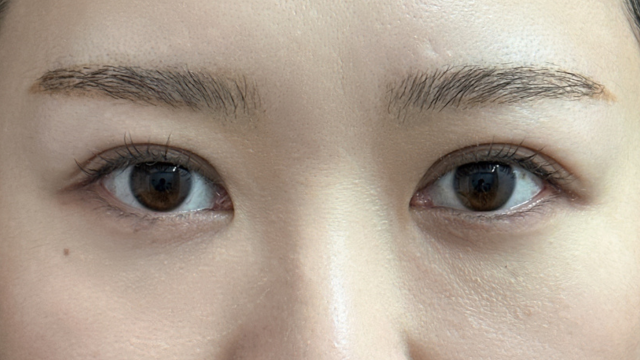 手术前的状态 其一