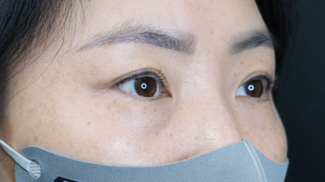 Postoperative Condition Part 1