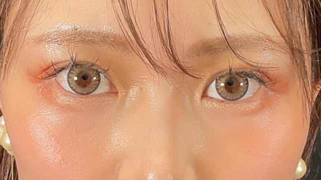 手术前的状态 其一