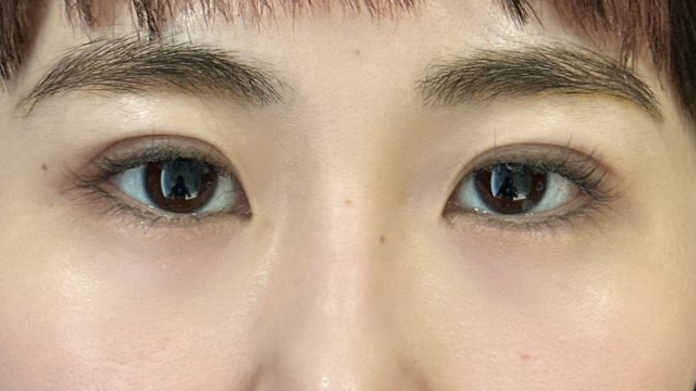 手术前的状态 其一