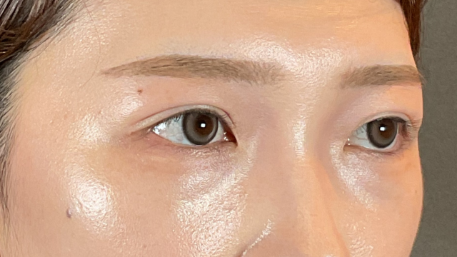 Postoperative Condition Part 1