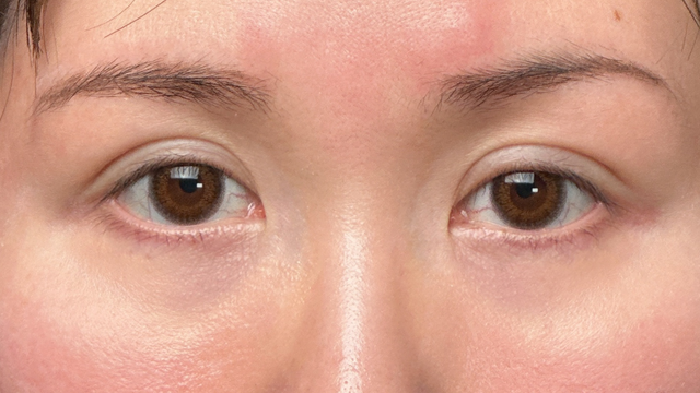 Postoperative Condition Part 1