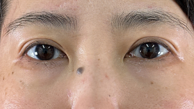 Postoperative Condition Part 1