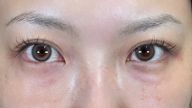 手术前的状态 其一