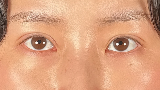 手术前的状态 其一