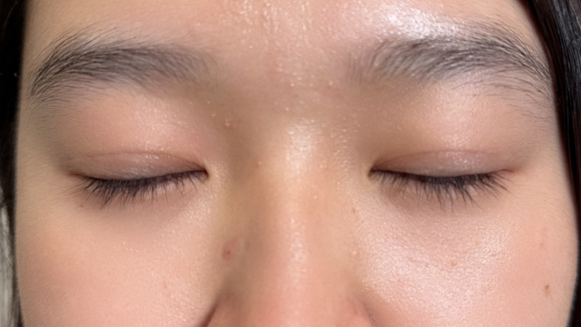 手术前的状态 其一