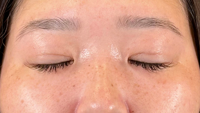 手术前的状态 其一