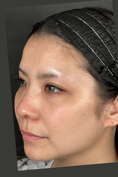 手术前的状态 其一